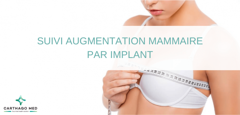 Suivi Augmentation Mammaire Par Implant Conseils Utiles