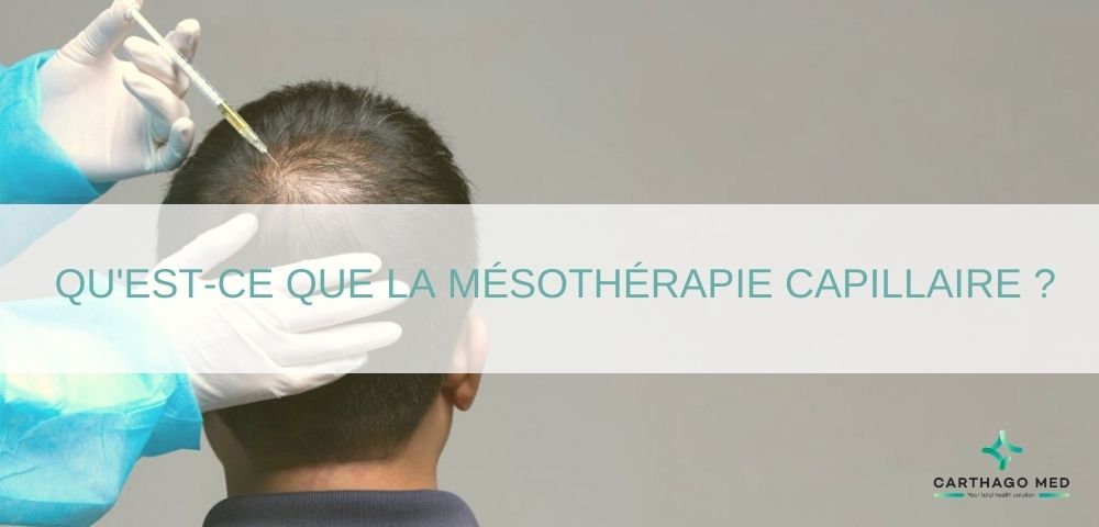 mesotherapie-cheveux