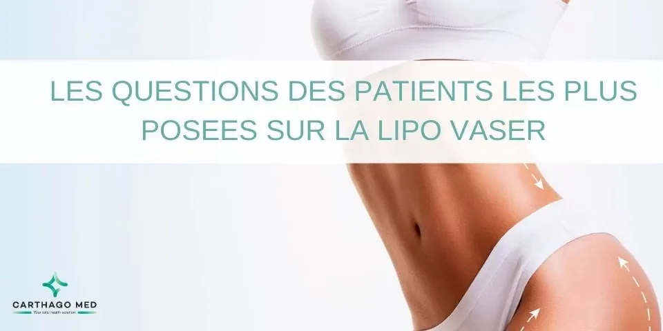 lipo vaser