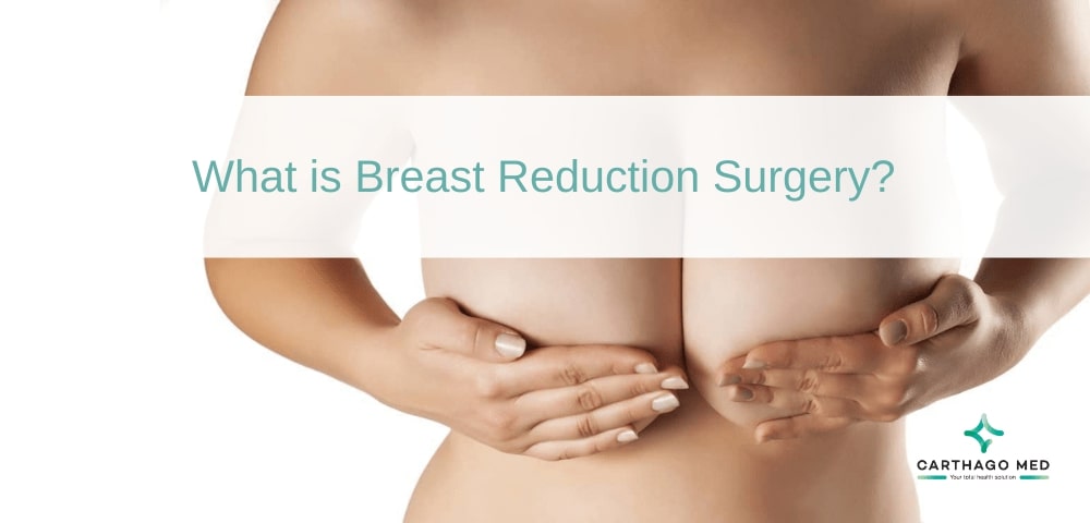  Breast Reduction