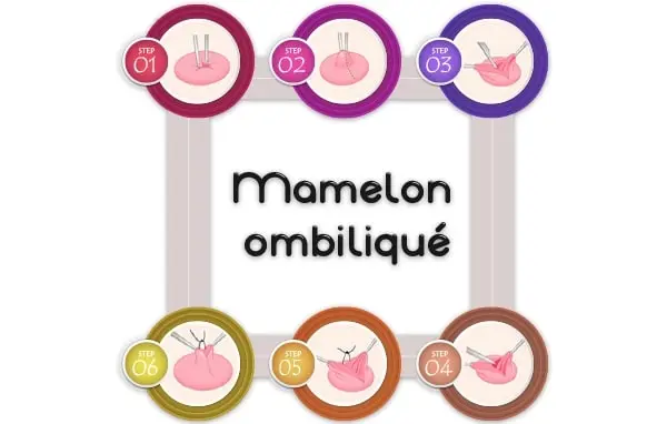 mamelon ombilique