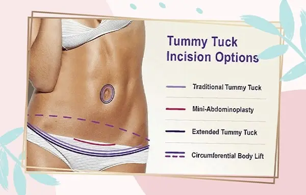 Tummy Tuck Recovery